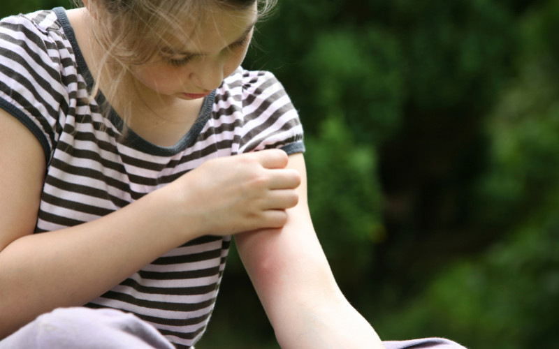 Astuces essentielles pour apaiser les piqûres de moustiques